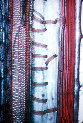 Primary_Xylem_Cells2